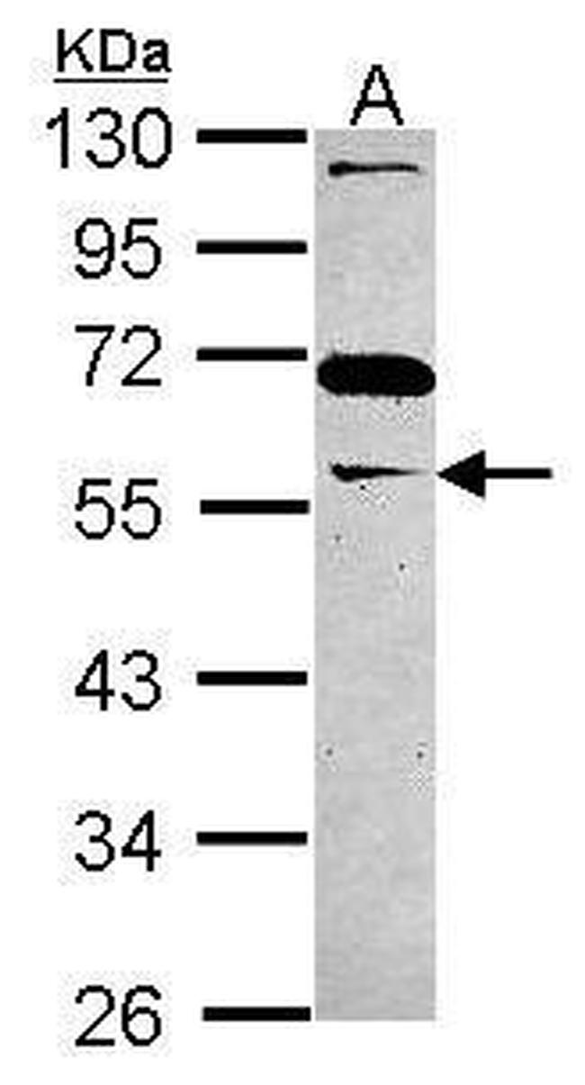 GAS7 Antibody in Western Blot (WB)