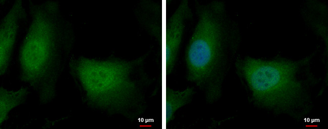 DENR Antibody in Immunocytochemistry (ICC/IF)