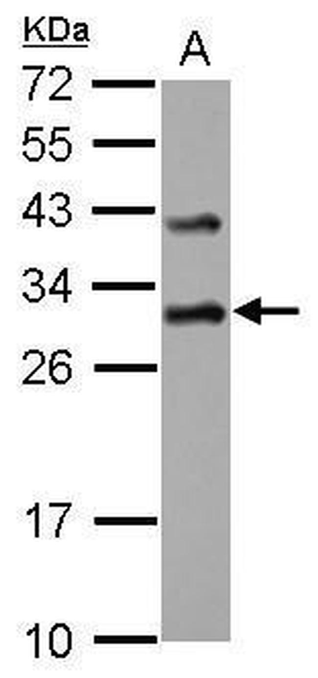 DENR Antibody in Western Blot (WB)