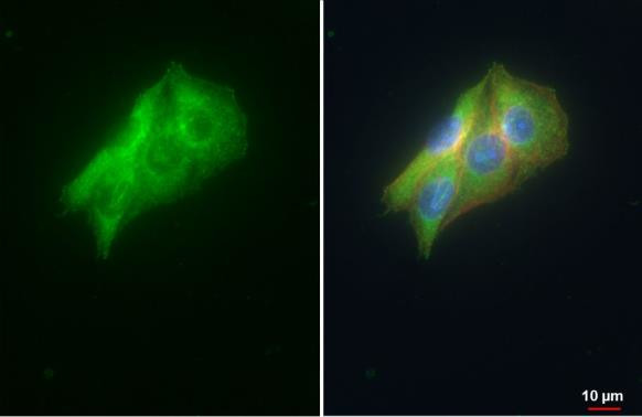 VDP Antibody in Immunocytochemistry (ICC/IF)