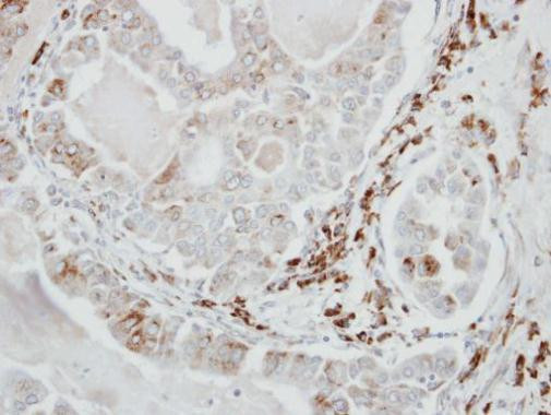 VDP Antibody in Immunohistochemistry (Paraffin) (IHC (P))