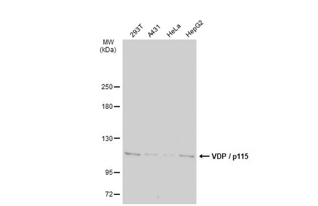 VDP Antibody in Western Blot (WB)