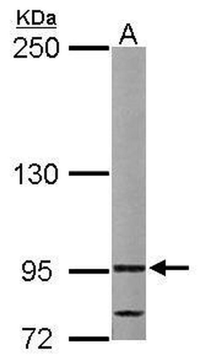 VDP Antibody in Western Blot (WB)