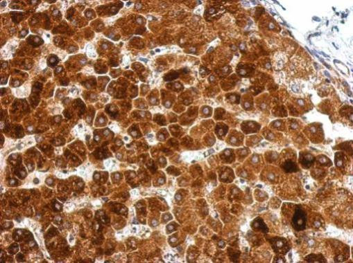 GPAA1 Antibody in Immunohistochemistry (Paraffin) (IHC (P))