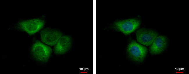 EIF2B4 Antibody in Immunocytochemistry (ICC/IF)