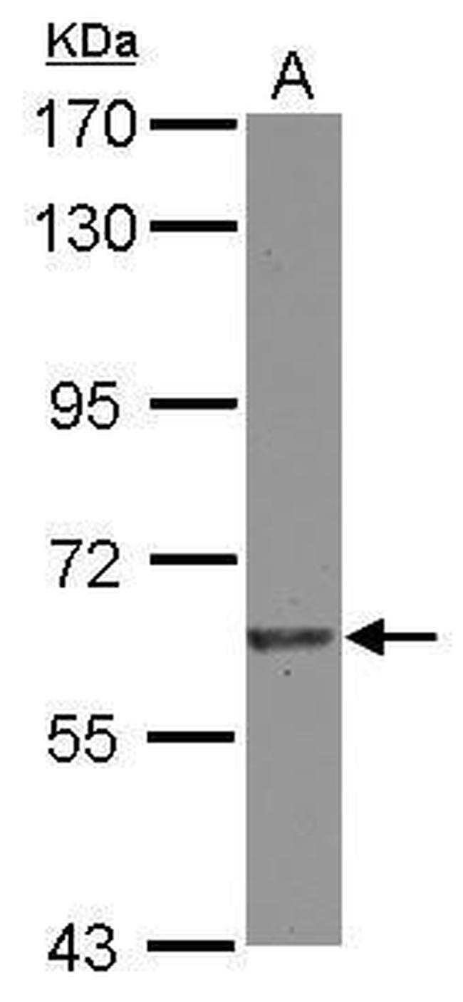 EIF2B4 Antibody in Western Blot (WB)