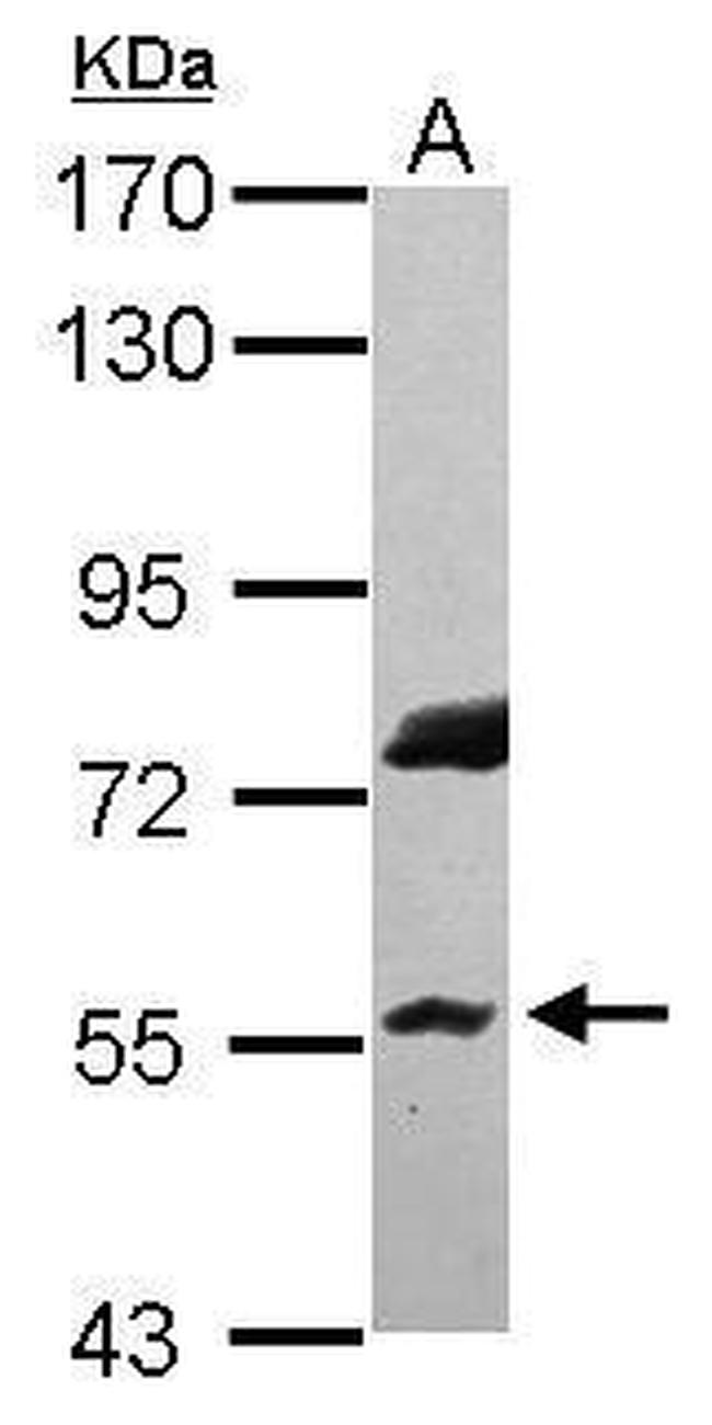 RNF8 Antibody in Western Blot (WB)