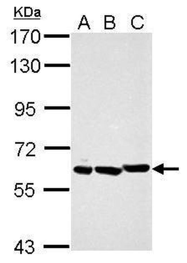 PIAS2 Antibody in Western Blot (WB)