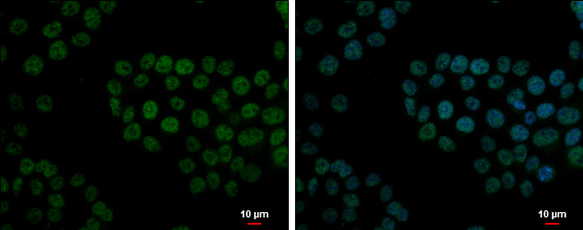 FCP1 Antibody in Immunocytochemistry (ICC/IF)