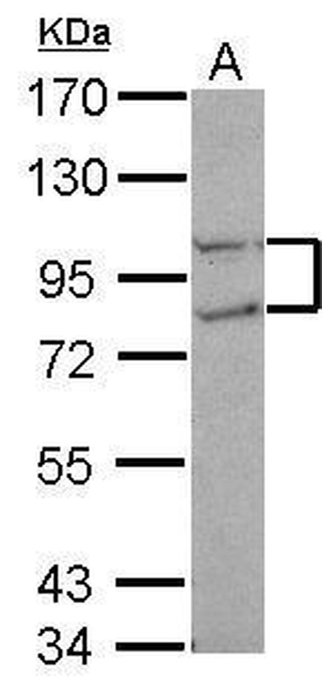 FCP1 Antibody in Western Blot (WB)