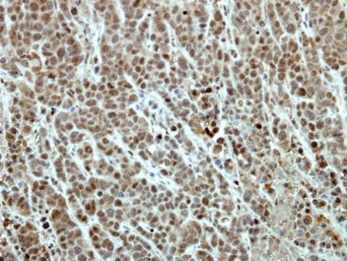 EFTUD2 Antibody in Immunohistochemistry (Paraffin) (IHC (P))