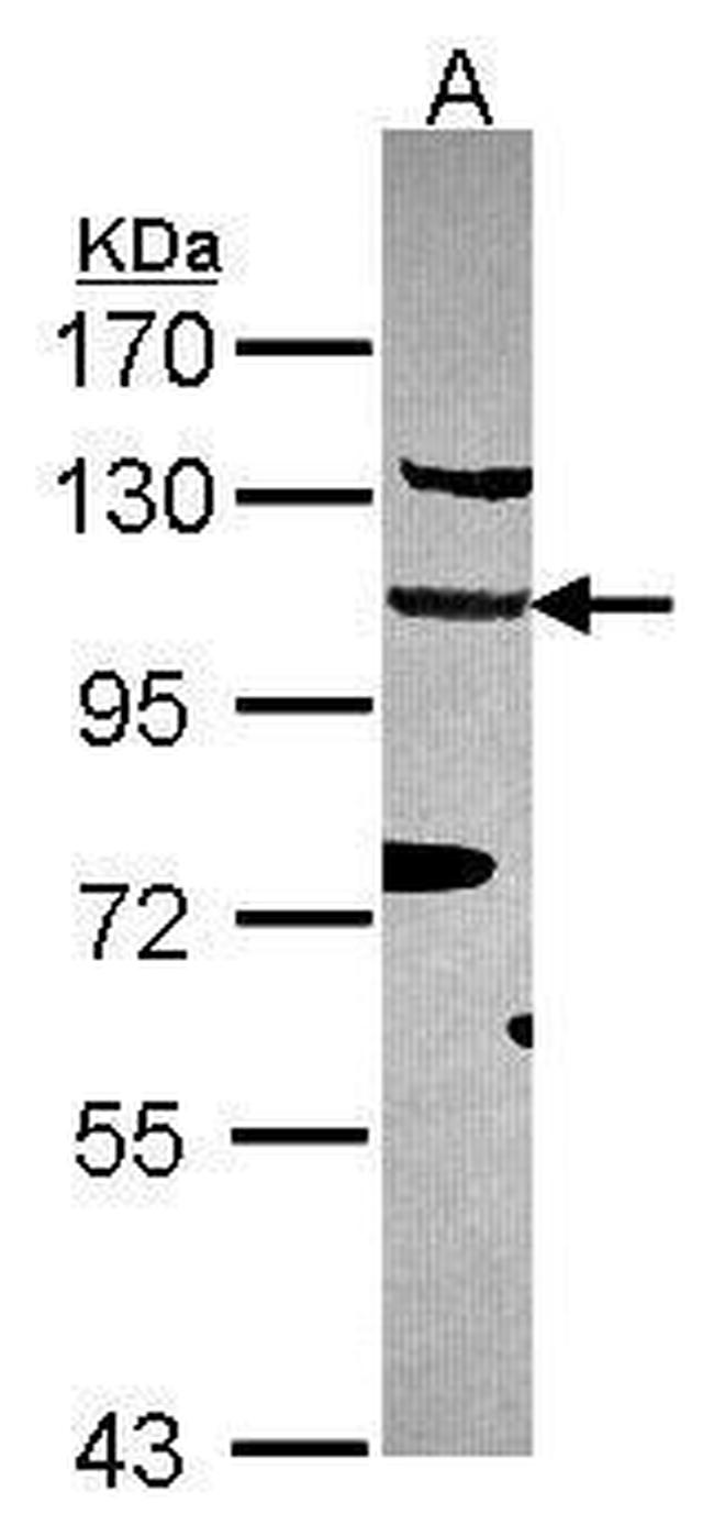 EFTUD2 Antibody in Western Blot (WB)