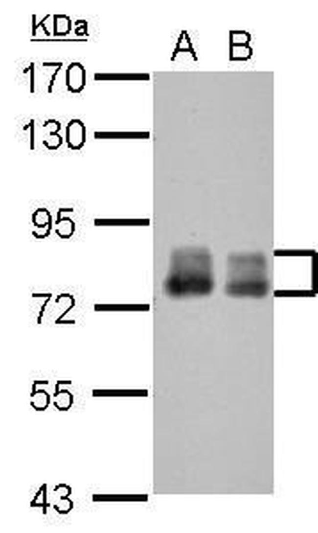 Placental Alkaline Phosphatase Antibody in Western Blot (WB)