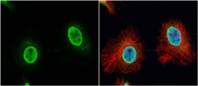 VPS4B Antibody in Immunocytochemistry (ICC/IF)