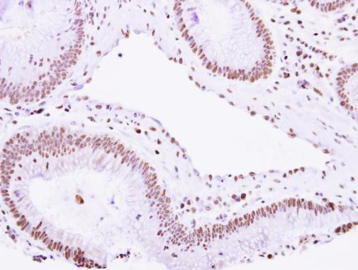 VPS4B Antibody in Immunohistochemistry (Paraffin) (IHC (P))