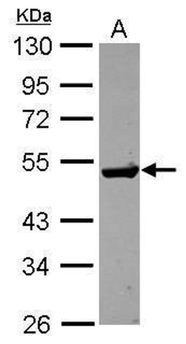 GDA Antibody in Western Blot (WB)