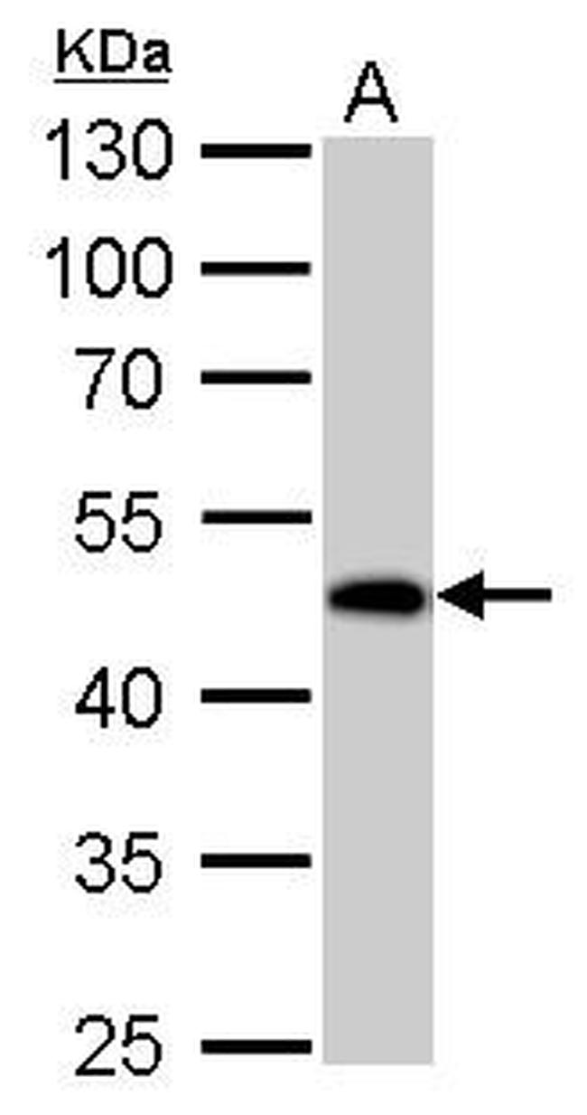 GDA Antibody in Western Blot (WB)