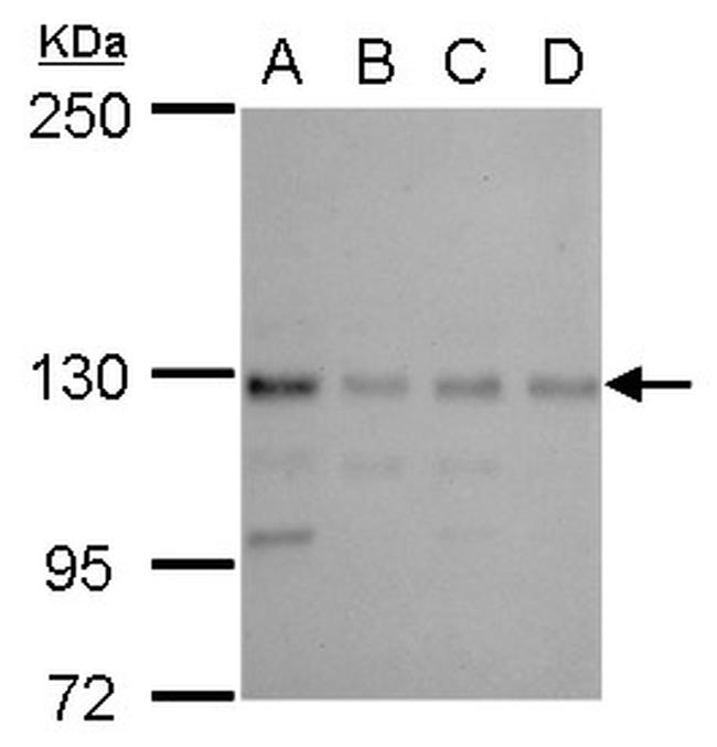 CTR9 Antibody in Western Blot (WB)