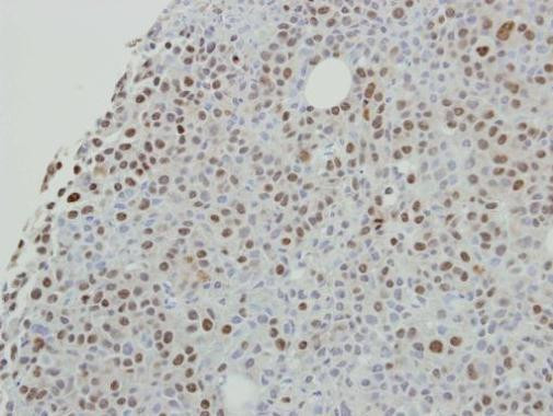 SAFB2 Antibody in Immunohistochemistry (Paraffin) (IHC (P))