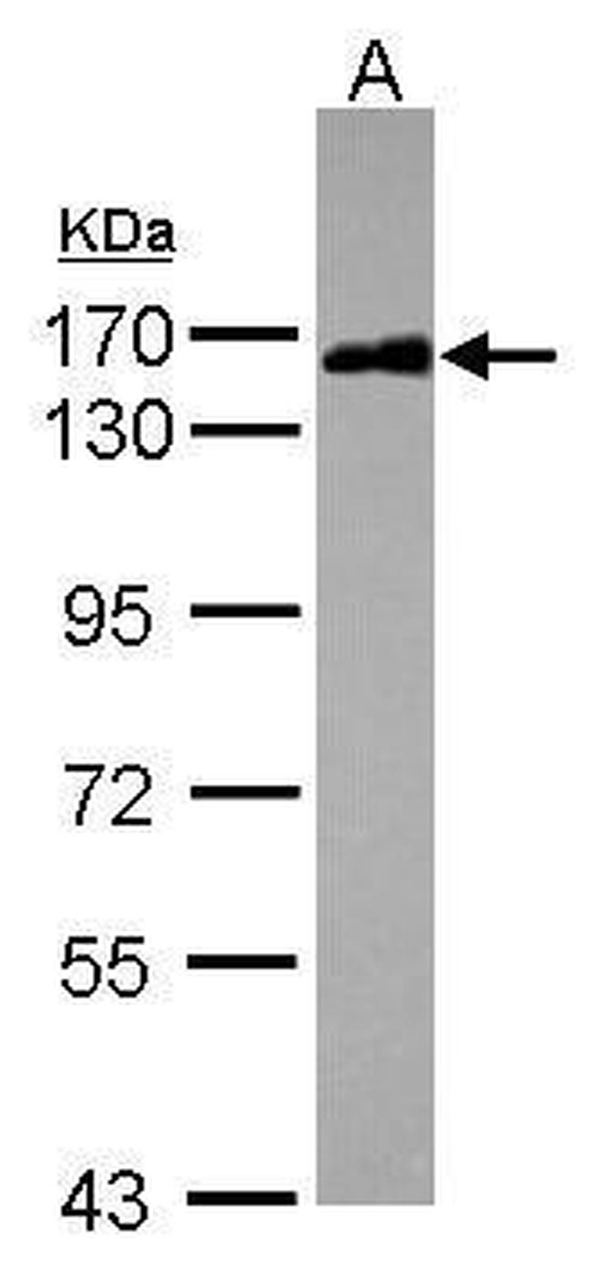 SAFB2 Antibody in Western Blot (WB)