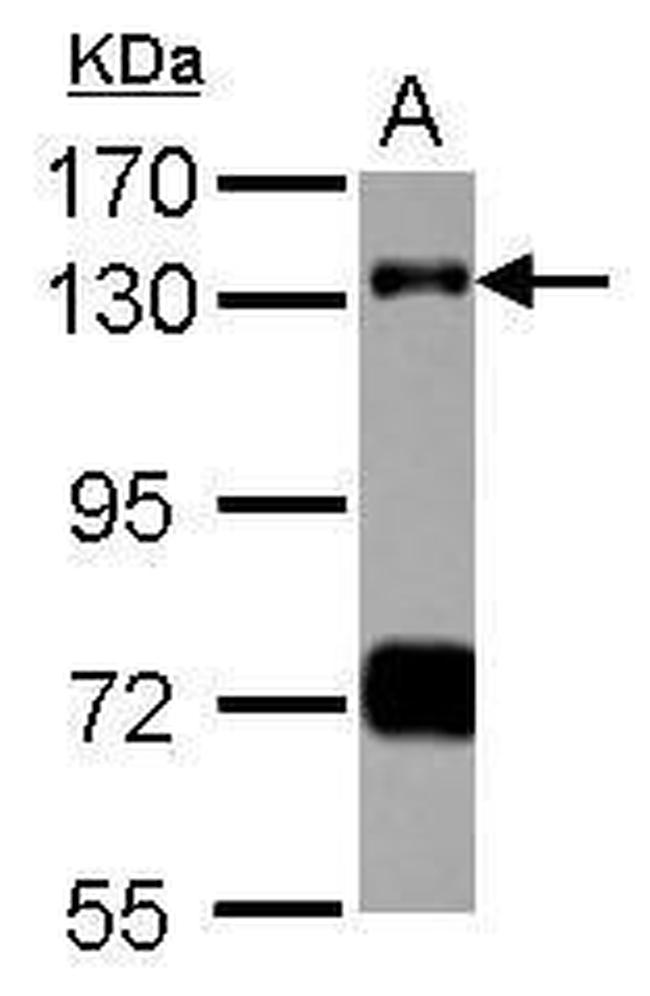 RNF40 Antibody in Western Blot (WB)