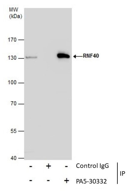 RNF40 Antibody in Immunoprecipitation (IP)