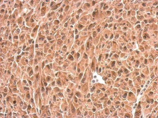 PSMD6 Antibody in Immunohistochemistry (Paraffin) (IHC (P))