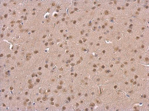 PSMD6 Antibody in Immunohistochemistry (Paraffin) (IHC (P))