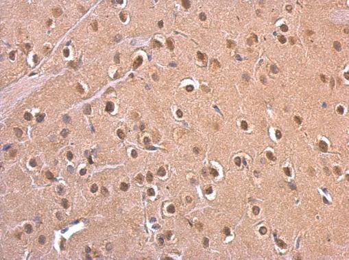 PSMD6 Antibody in Immunohistochemistry (Paraffin) (IHC (P))