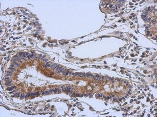 DGCR2 Antibody in Immunohistochemistry (Paraffin) (IHC (P))