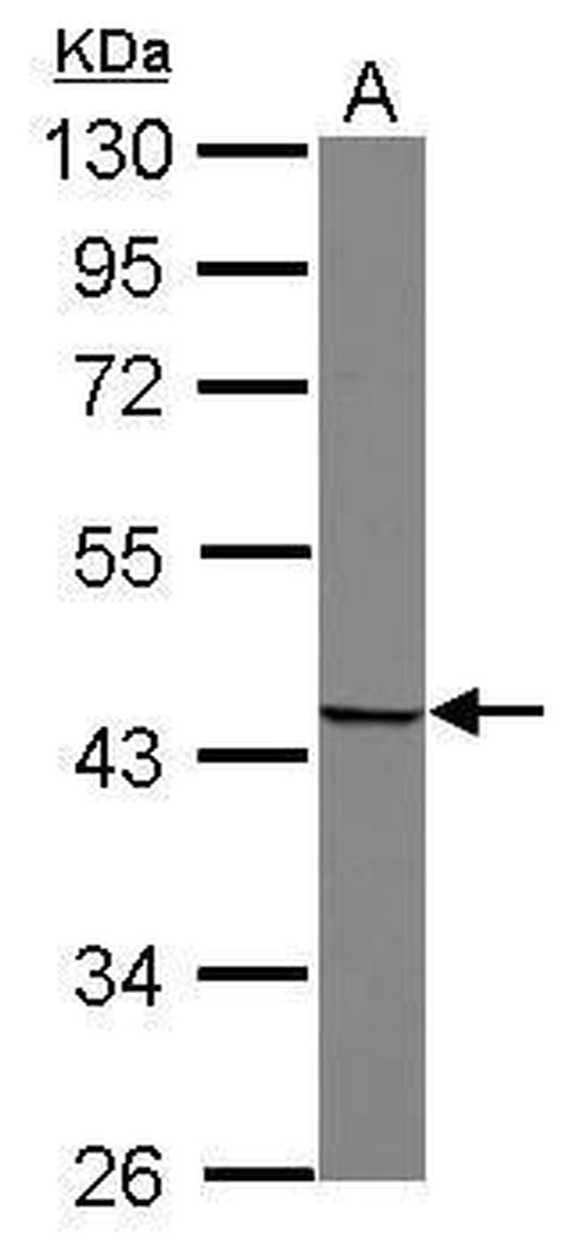 SNUPN Antibody in Western Blot (WB)