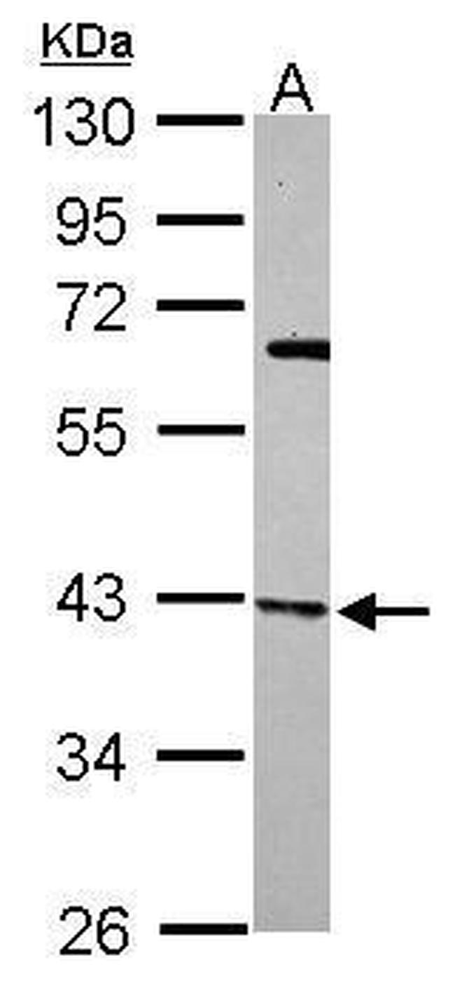 p41-ARCb Antibody in Western Blot (WB)