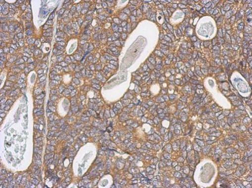 Arp3 Antibody in Immunohistochemistry (Paraffin) (IHC (P))