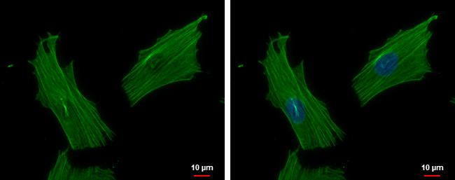 ACTR1B Antibody in Immunocytochemistry (ICC/IF)