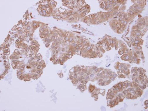 ACTR1B Antibody in Immunohistochemistry (Paraffin) (IHC (P))