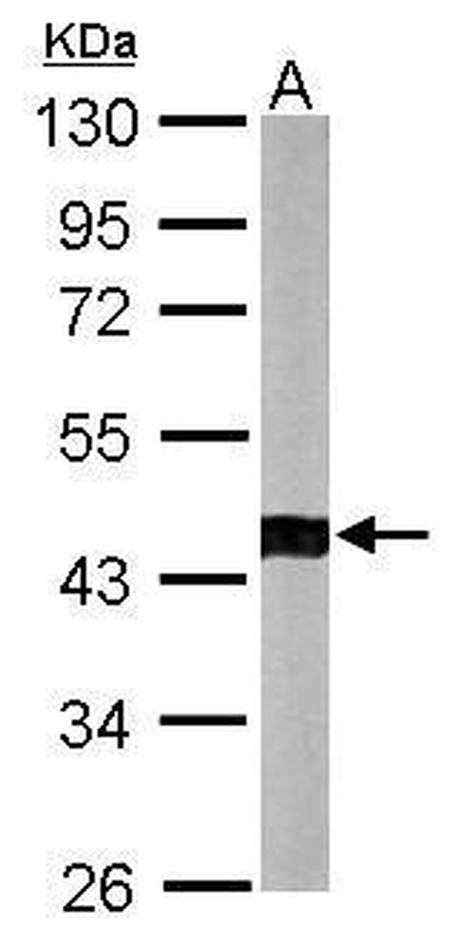 ACTR1B Antibody in Western Blot (WB)