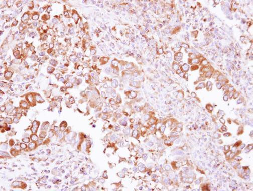 ACTR1A Antibody in Immunohistochemistry (Paraffin) (IHC (P))