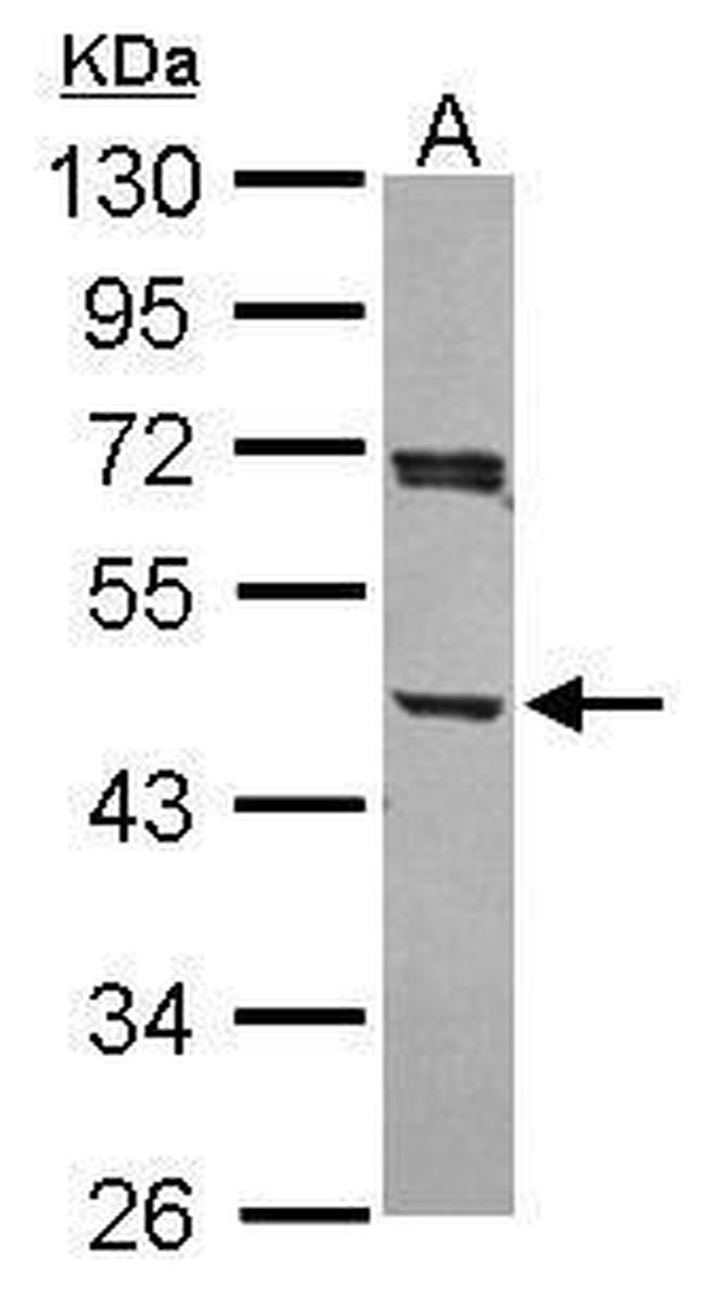 ACTR1A Antibody in Western Blot (WB)