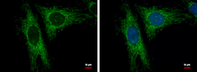 LRP130 Antibody in Immunocytochemistry (ICC/IF)