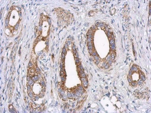 LRP130 Antibody in Immunohistochemistry (Paraffin) (IHC (P))