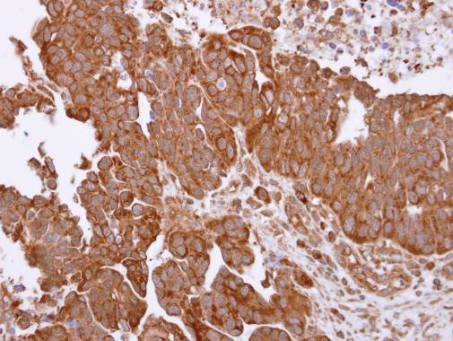 TRAP1 Antibody in Immunohistochemistry (Paraffin) (IHC (P))