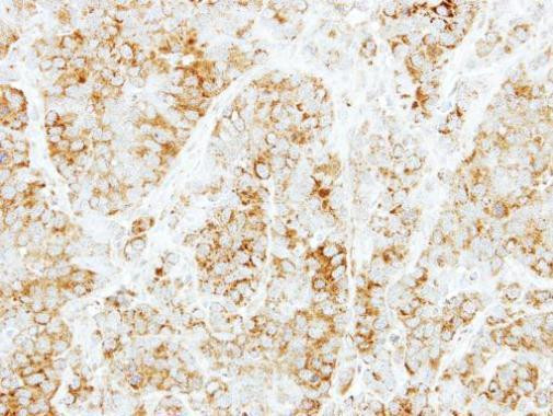 Syntaxin 6 Antibody in Immunohistochemistry (Paraffin) (IHC (P))