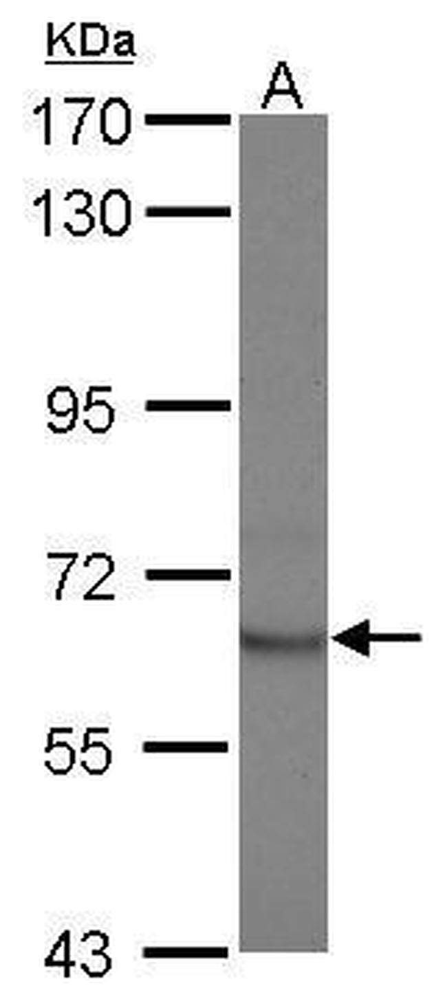 STAM2 Antibody in Western Blot (WB)