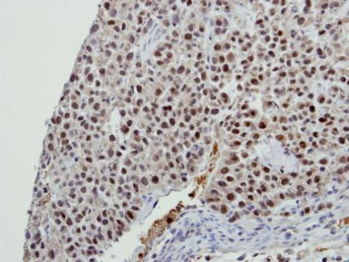 BCAS2 Antibody in Immunohistochemistry (Paraffin) (IHC (P))