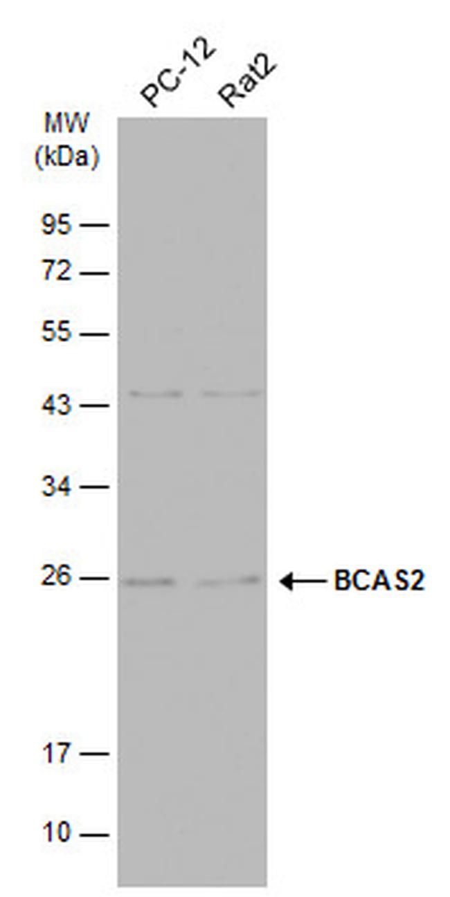 BCAS2 Antibody in Western Blot (WB)