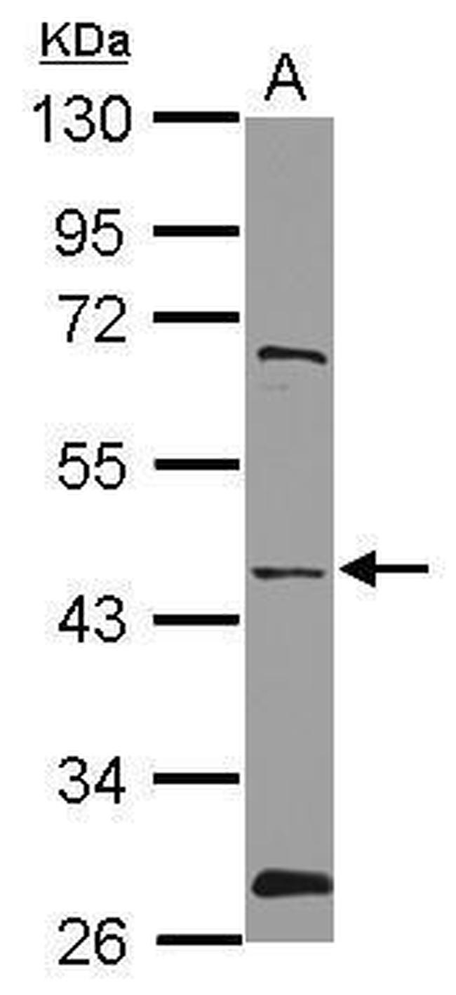 NMUR1 Antibody in Western Blot (WB)