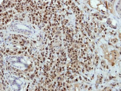 BRAF35 Antibody in Immunohistochemistry (Paraffin) (IHC (P))