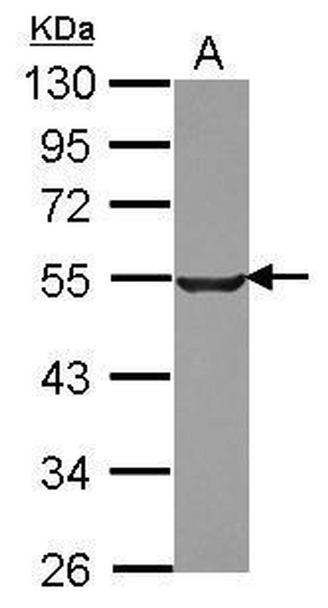 Tubulin beta-2C Antibody in Western Blot (WB)