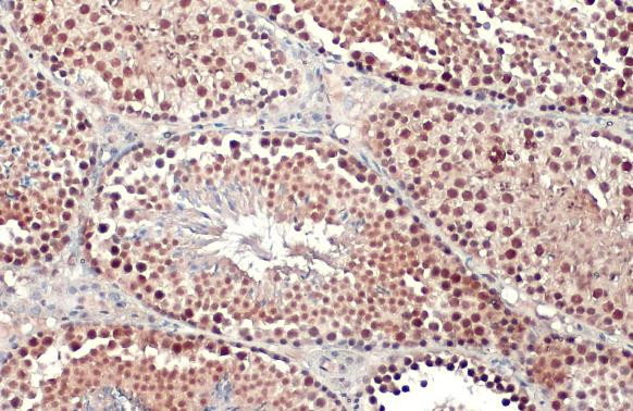 PRMT5 Antibody in Immunohistochemistry (Paraffin) (IHC (P))