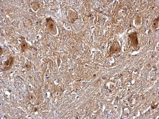 PRMT5 Antibody in Immunohistochemistry (Paraffin) (IHC (P))